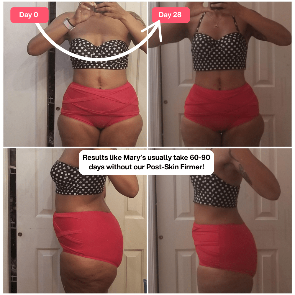 Bella Vibes™ Post Reafirmante de Piel