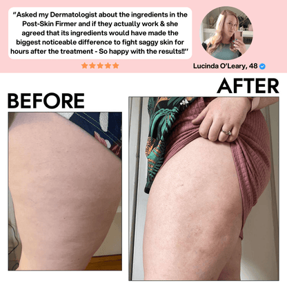 Bella Vibes™ Post Reafirmante de Piel