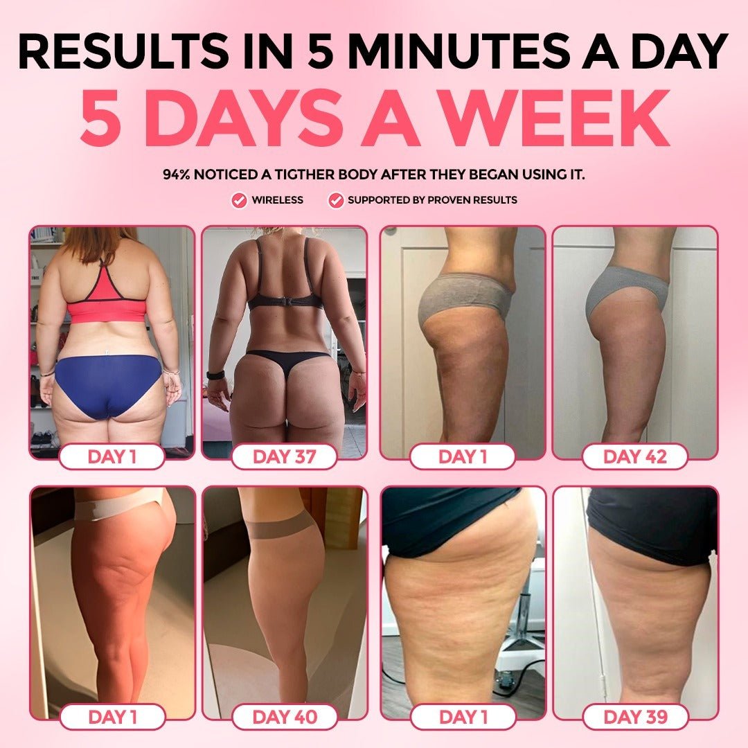 Kit para el alivio de la celulitis BellaVibes™