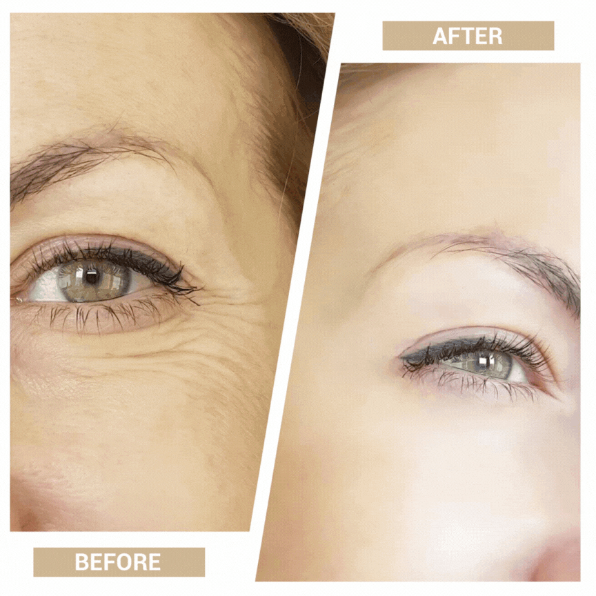 Bella Vibes™ Tonificador & Rejuvenecedor de rostro 3 en 1